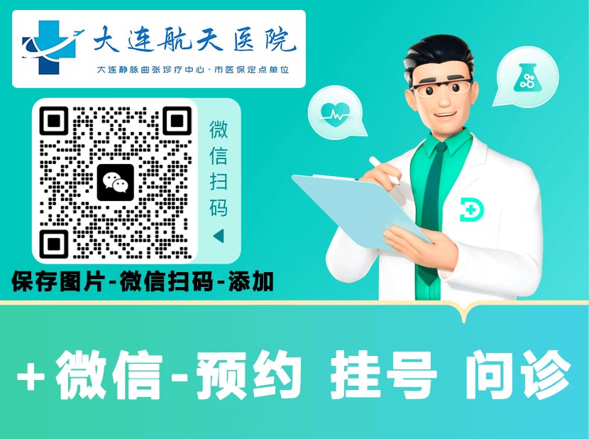 静脉曲治疗