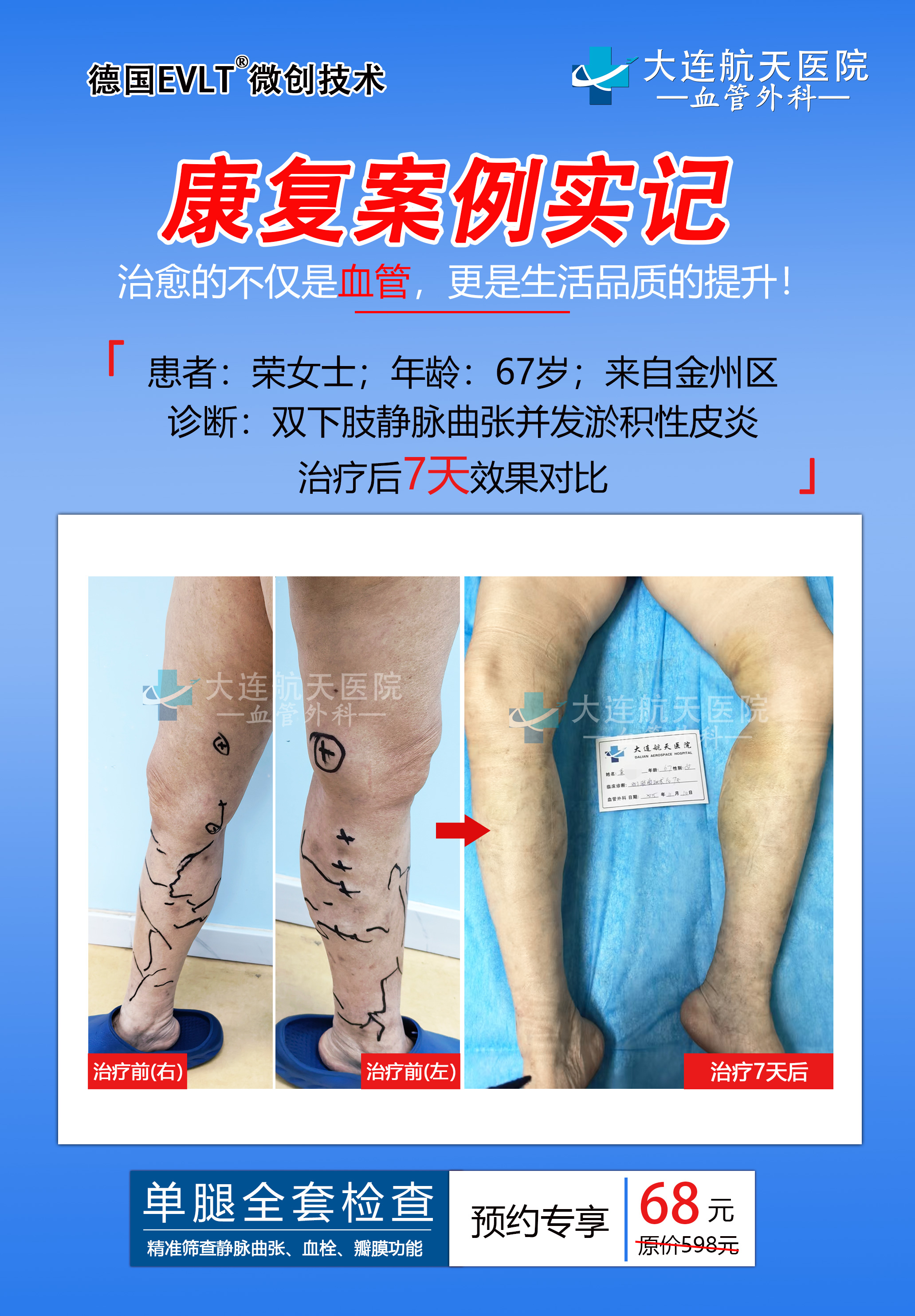 大连航天医院下肢血管病专科(图1)